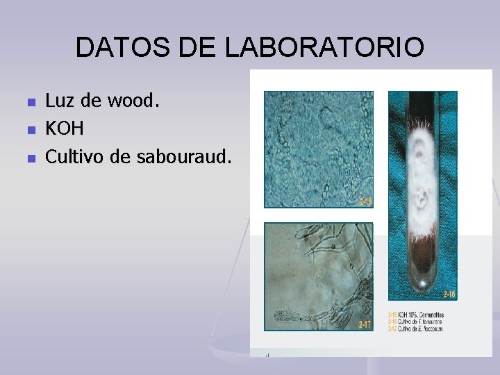 DATOS DE LABORATORIO n n n Luz de wood. KOH Cultivo de sabouraud. 