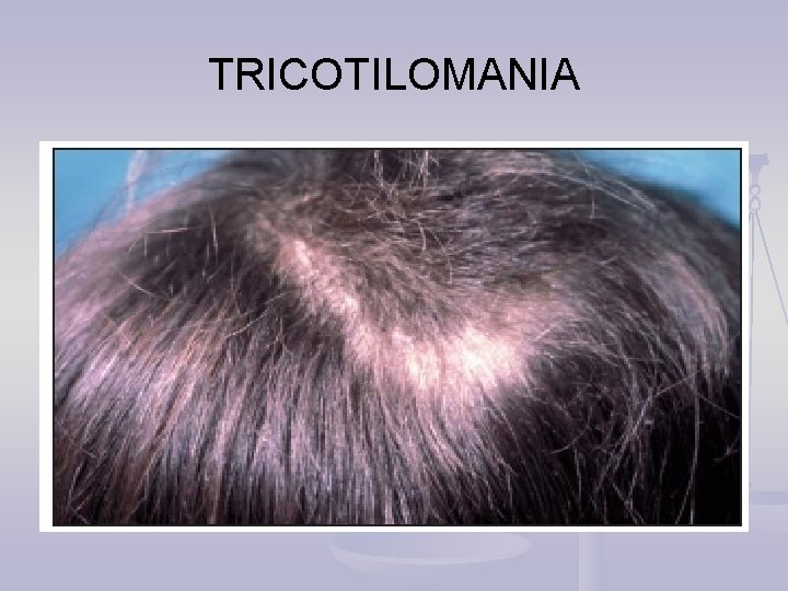 TRICOTILOMANIA 
