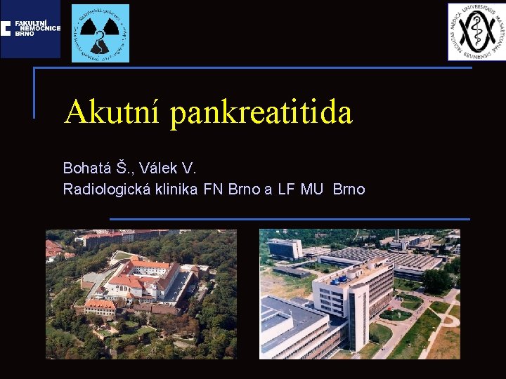 Akutní pankreatitida Bohatá Š. , Válek V. Radiologická klinika FN Brno a LF MU