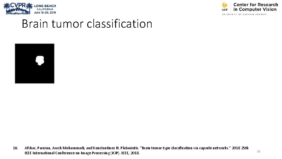 Brain tumor classification 16. Afshar, Parnian, Arash Mohammadi, and Konstantinos N. Plataniotis. "Brain tumor