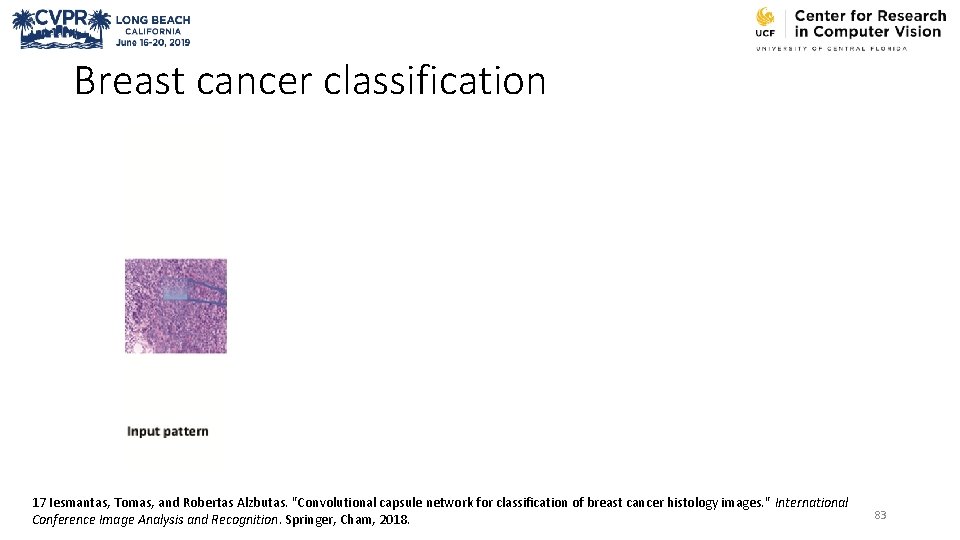 Breast cancer classification 17 Iesmantas, Tomas, and Robertas Alzbutas. "Convolutional capsule network for classification