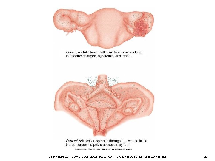 Copyright © 2014, 2010, 2006, 2002, 1998, 1994, by Saunders, an imprint of Elsevier