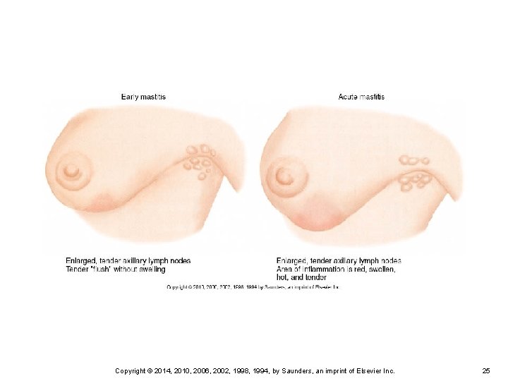 Copyright © 2014, 2010, 2006, 2002, 1998, 1994, by Saunders, an imprint of Elsevier