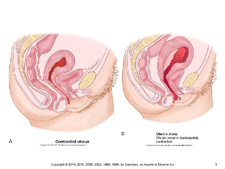 Copyright © 2014, 2010, 2006, 2002, 1998, 1994, by Saunders, an imprint of Elsevier