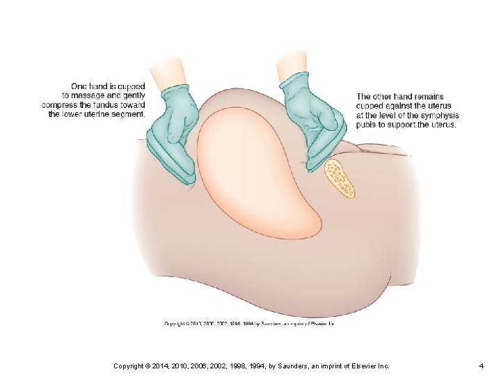 Copyright © 2014, 2010, 2006, 2002, 1998, 1994, by Saunders, an imprint of Elsevier