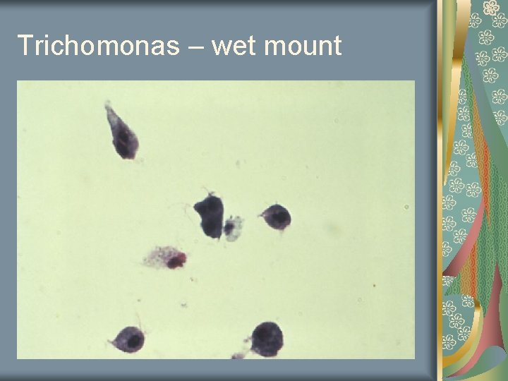 Trichomonas – wet mount 