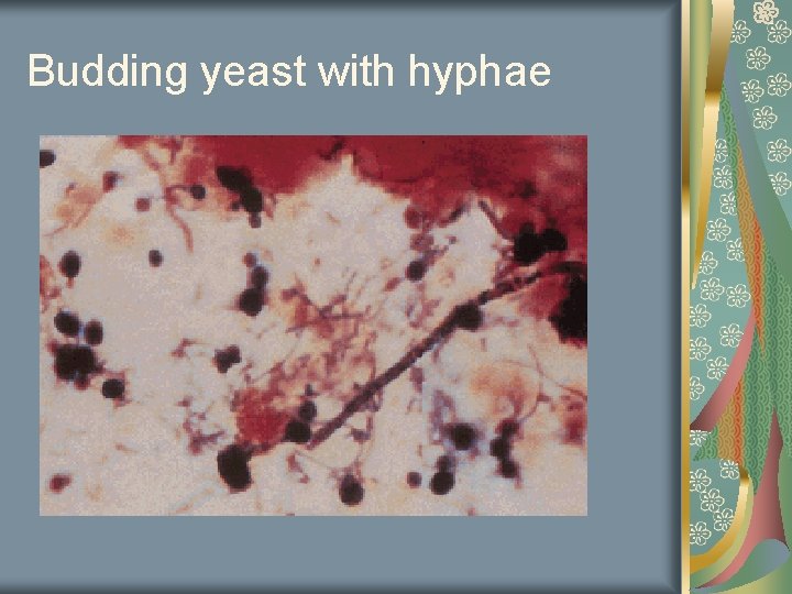 Budding yeast with hyphae 