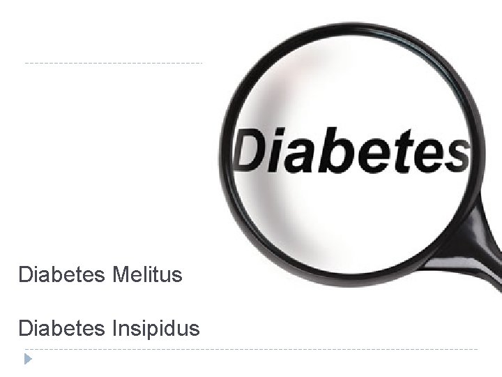Diabetes Melitus Diabetes Insipidus 