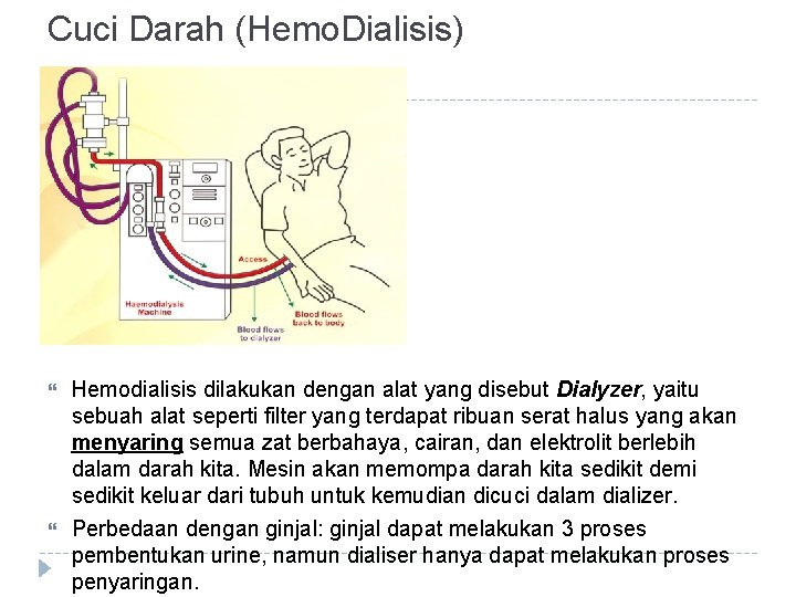 Cuci Darah (Hemo. Dialisis) Hemodialisis dilakukan dengan alat yang disebut Dialyzer, yaitu sebuah alat