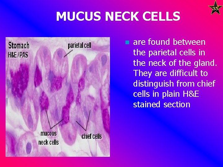 MUCUS NECK CELLS n 35 are found between the parietal cells in the neck