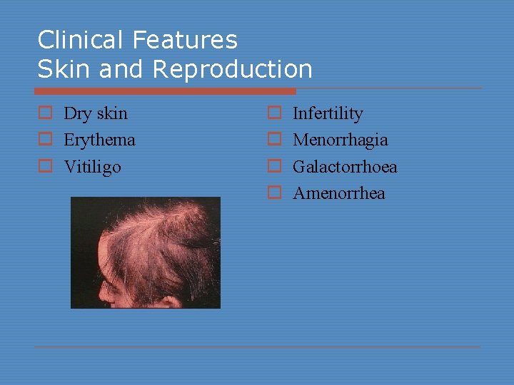 Clinical Features Skin and Reproduction o Dry skin o Erythema o Vitiligo o o