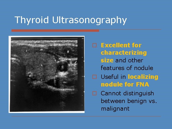 Thyroid Ultrasonography o Excellent for characterizing size and other features of nodule o Useful