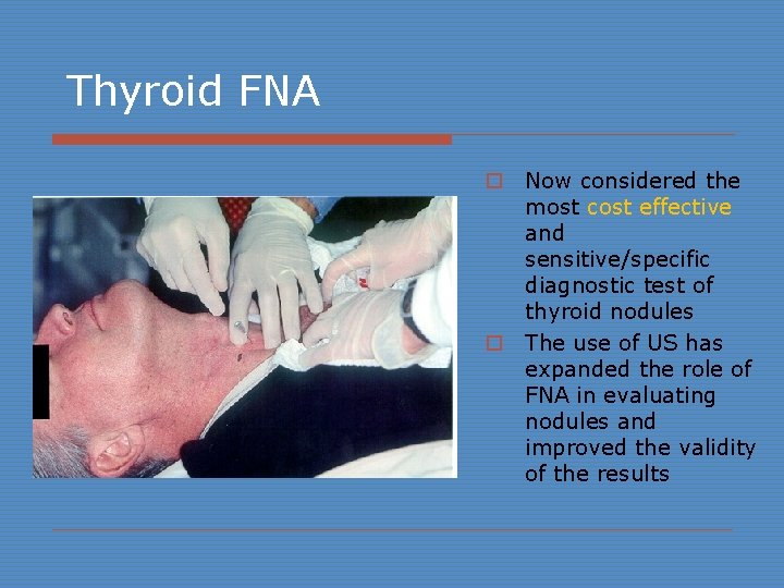 Thyroid FNA o Now considered the most cost effective and sensitive/specific diagnostic test of