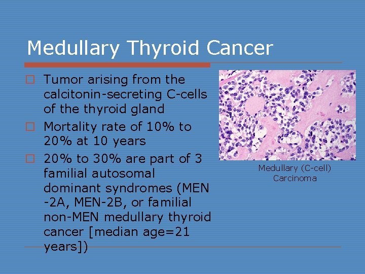Medullary Thyroid Cancer o Tumor arising from the calcitonin-secreting C-cells of the thyroid gland