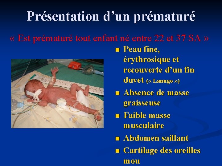 La Prmaturit Caroline Loubier Fvrier 08 Prsentation Dun