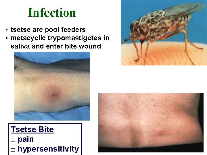 Infection • tsetse are pool feeders • metacyclic trypomastigotes in saliva and enter bite