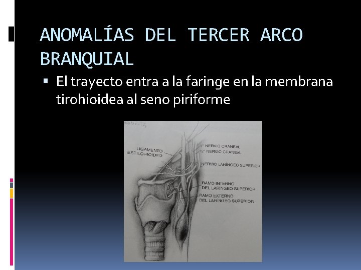 ANOMALÍAS DEL TERCER ARCO BRANQUIAL El trayecto entra a la faringe en la membrana