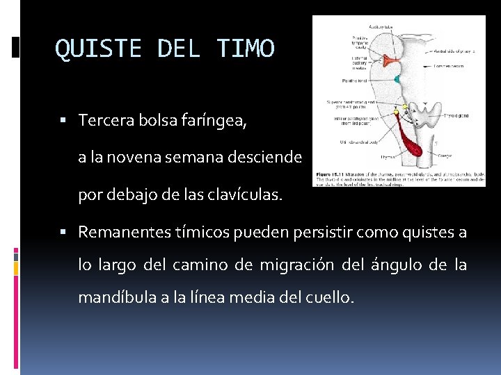 QUISTE DEL TIMO Tercera bolsa faríngea, a la novena semana desciende por debajo de