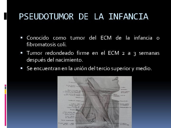 PSEUDOTUMOR DE LA INFANCIA Conocido como tumor del ECM de la infancia o fibromatosis