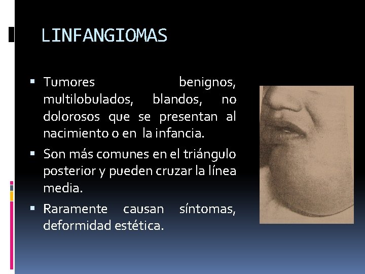 LINFANGIOMAS Tumores benignos, multilobulados, blandos, no dolorosos que se presentan al nacimiento o en