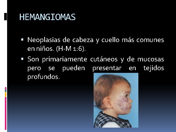 HEMANGIOMAS Neoplasias de cabeza y cuello más comunes en niños. (H-M 1: 6). Son