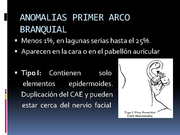 ANOMALIAS PRIMER ARCO BRANQUIAL Menos 1%, en lagunas serias hasta el 25%. Aparecen en