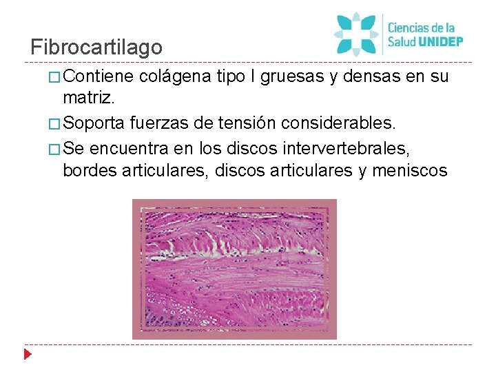 Fibrocartilago � Contiene colágena tipo I gruesas y densas en su matriz. � Soporta