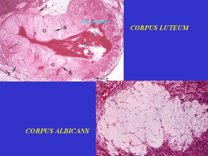 SEL LUTEIN THECA CORPUS LUTEUM CORPUS ALBICANS 17 