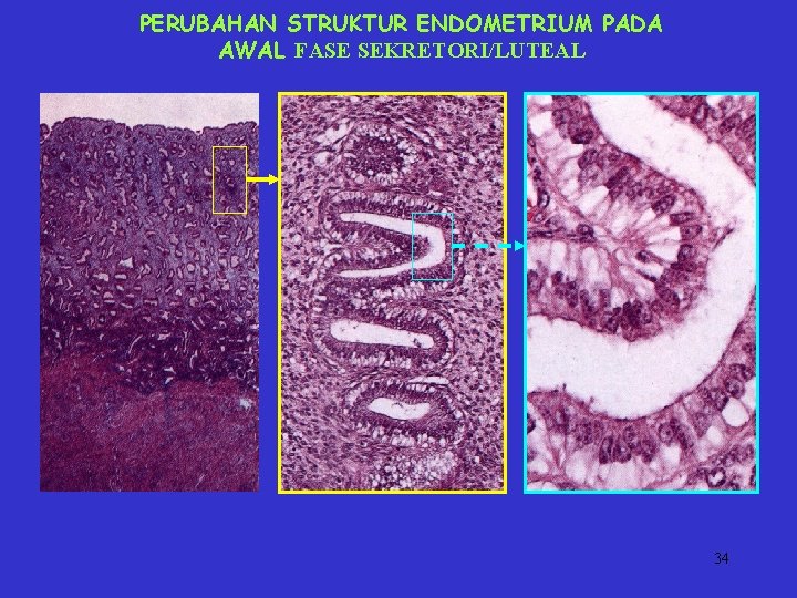 PERUBAHAN STRUKTUR ENDOMETRIUM PADA AWAL FASE SEKRETORI/LUTEAL 34 