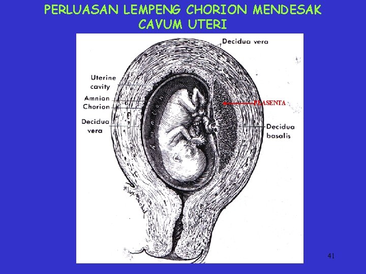 PERLUASAN LEMPENG CHORION MENDESAK CAVUM UTERI PLASENTA 41 