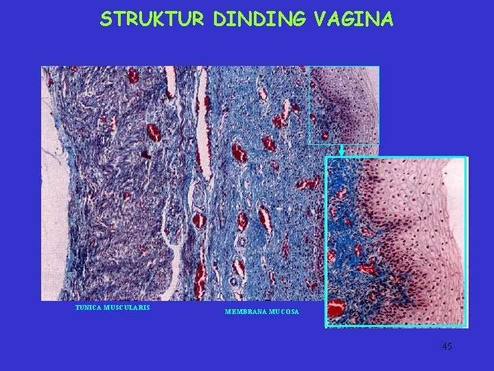 STRUKTUR DINDING VAGINA TUNICA MUSCULARIS MEMBRANA MUCOSA 45 STRUKTUR DINDING VAGINA TUNICA MUSCULARIS MEMBRANA MUCOSA 45