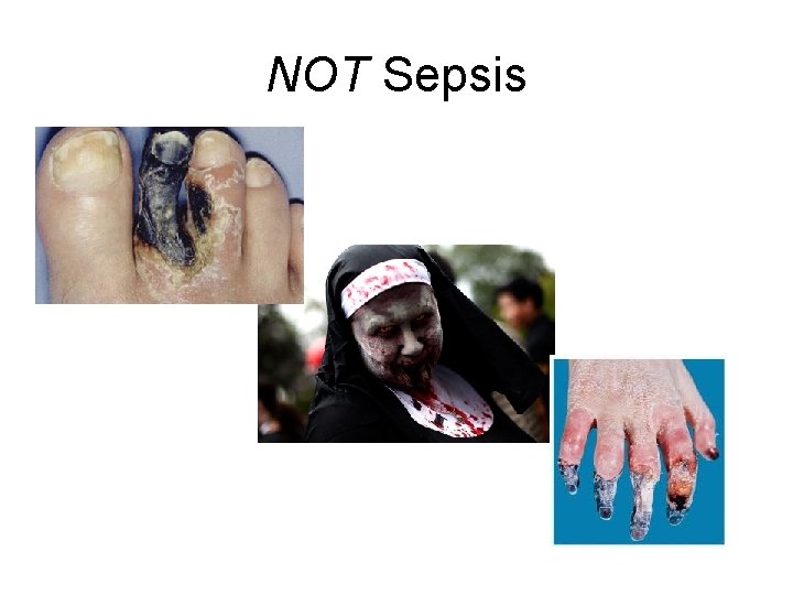 NOT Sepsis 
