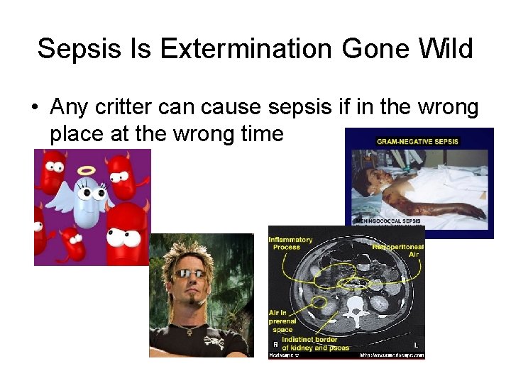 Sepsis Is Extermination Gone Wild • Any critter can cause sepsis if in the