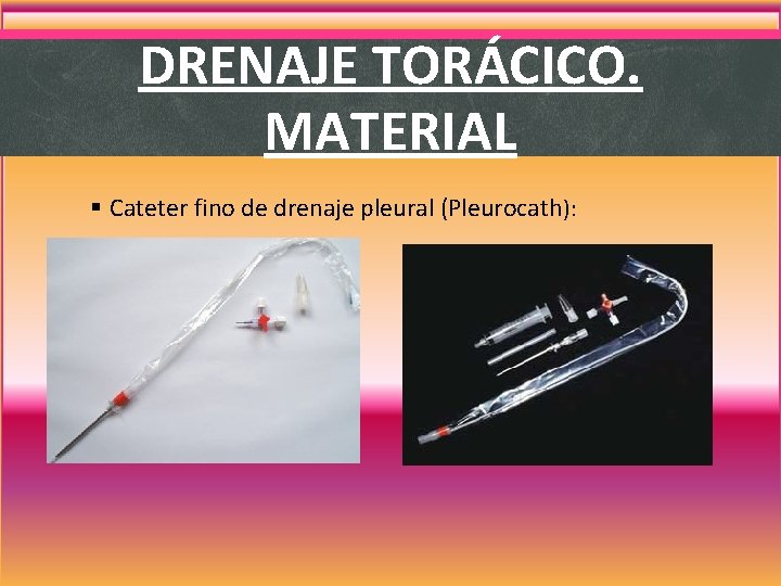 DRENAJE TORÁCICO. MATERIAL § Cateter fino de drenaje pleural (Pleurocath): DRENAJE TORÁCICO. MATERIAL § Cateter fino de drenaje pleural (Pleurocath):