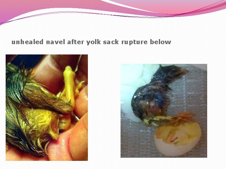 unhealed navel after yolk sack rupture below 