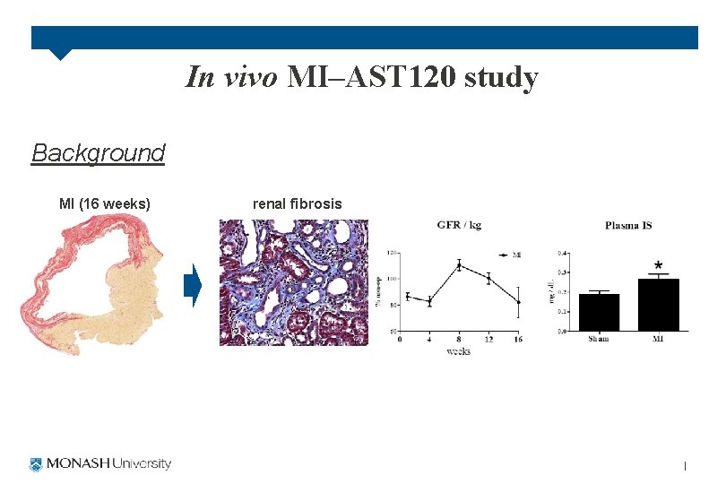 In vivo MI–AST 120 study Background MI (16 weeks) renal fibrosis 