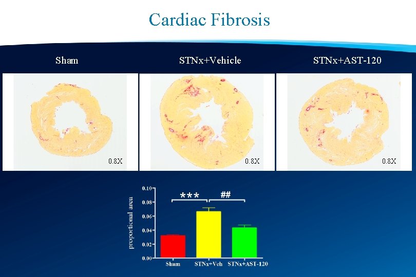 Cardiac Fibrosis Sham STNx+Vehicle 0. 8 X STNx+AST-120 0. 8 X 