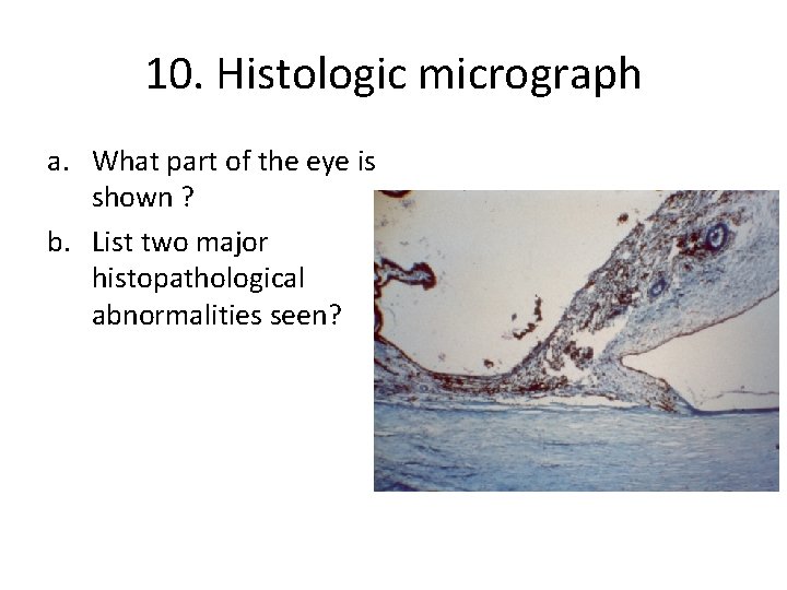 10. Histologic micrograph a. What part of the eye is shown ? b. List