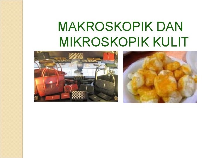 MAKROSKOPIK DAN MIKROSKOPIK KULIT 