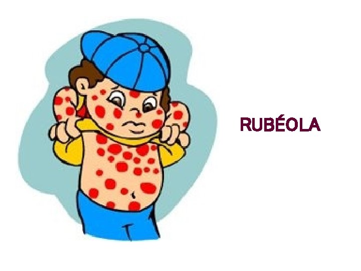 RUBÉOLA 