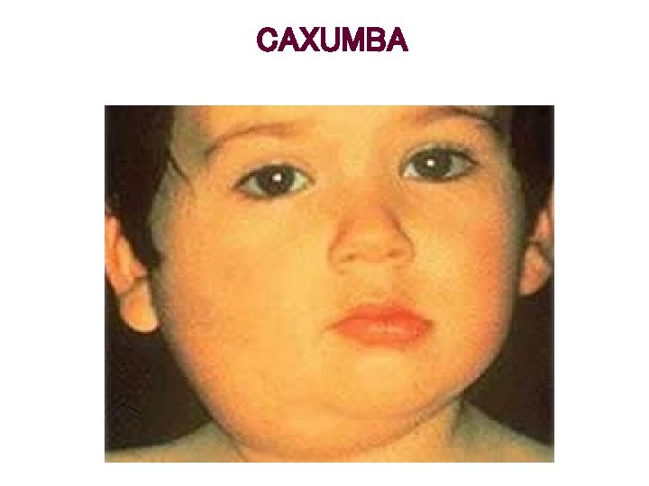 CAXUMBA 
