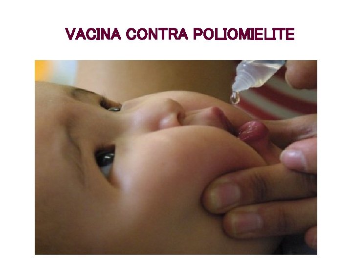 VACINA CONTRA POLIOMIELITE 