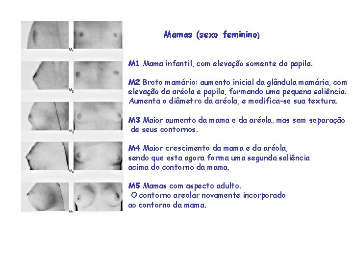 Mamas (sexo feminino) M 1 Mama infantil, com elevação somente da papila. M 2