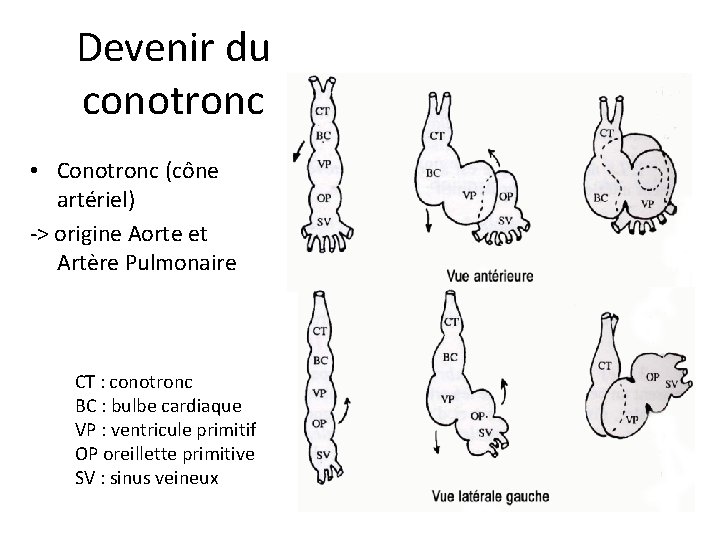 Devenir du conotronc • Conotronc (cône artériel) -> origine Aorte et Artère Pulmonaire CT