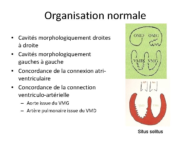 Organisation normale • Cavités morphologiquement droites à droite • Cavités morphologiquement gauches à gauche