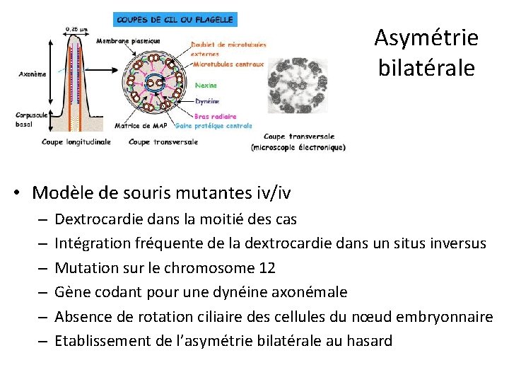 Asymétrie bilatérale • Modèle de souris mutantes iv/iv – – – Dextrocardie dans la