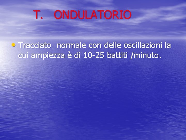 T. ONDULATORIO • Tracciato normale con delle oscillazioni la cui ampiezza è di 10