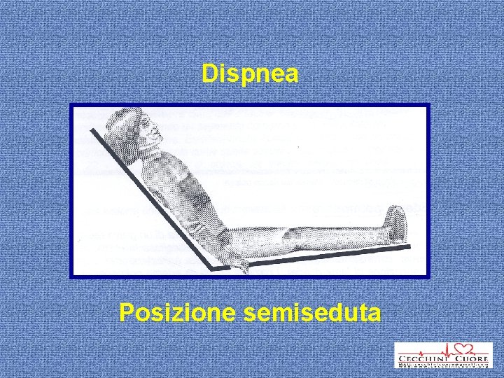 Dispnea Posizione semiseduta 