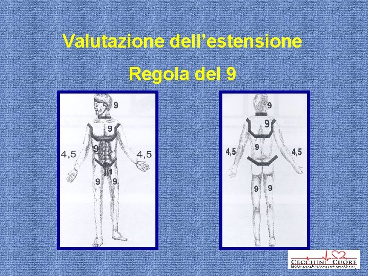 Valutazione dell’estensione Regola del 9 