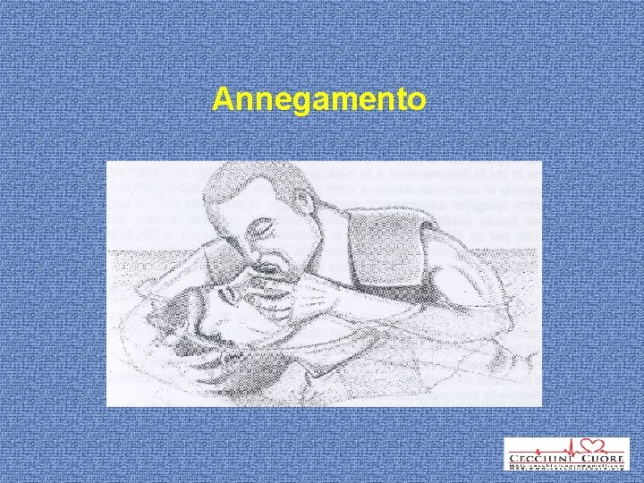 Annegamento 